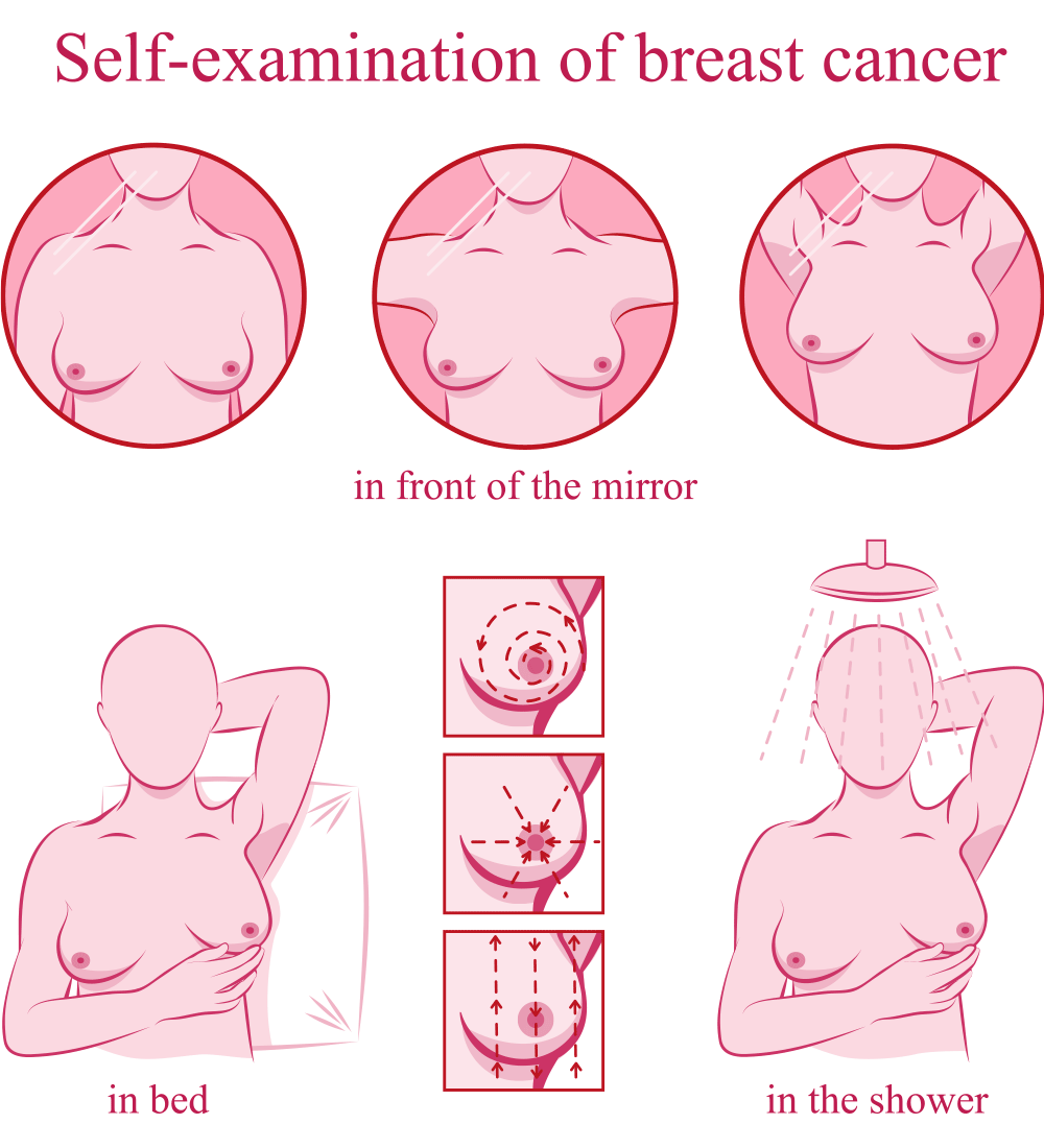 Self examination of breast cancer